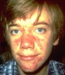 Quand je souris, mon visage explose...